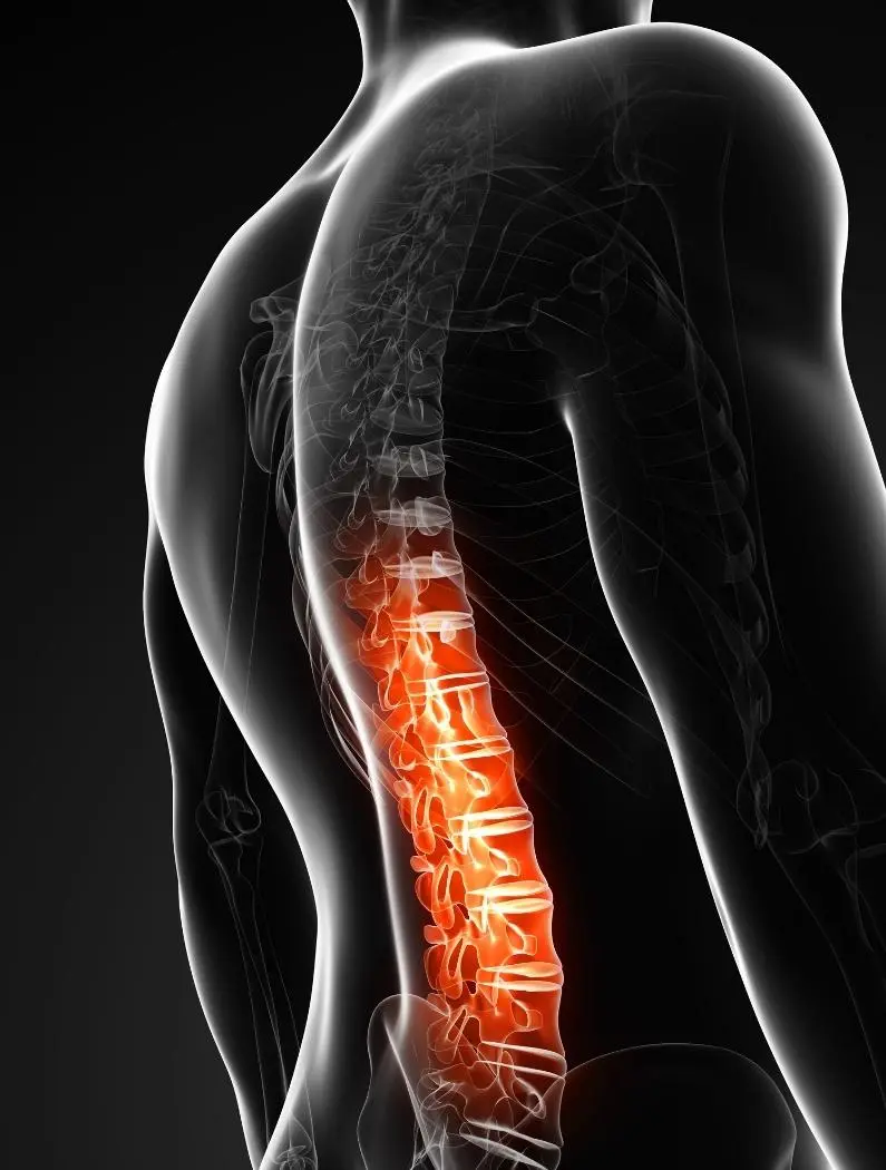 Lumbalgia y dolor lumbar — atención clínica en Dolorfin